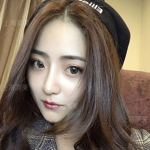 上海美萊整形醫(yī)院隆鼻整形