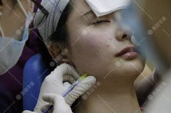 貴陽(yáng)美萊打瘦臉針價(jià)錢