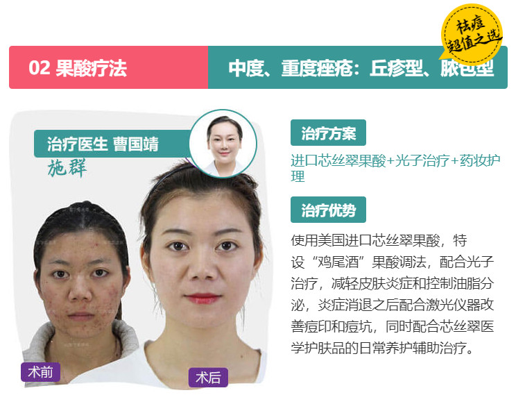 經(jīng)常長(zhǎng)痘,美萊果酸祛痘效果怎么樣