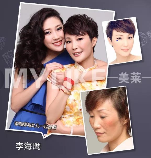 化妝品會讓黃褐斑增長嗎,預防黃褐斑有哪些方法