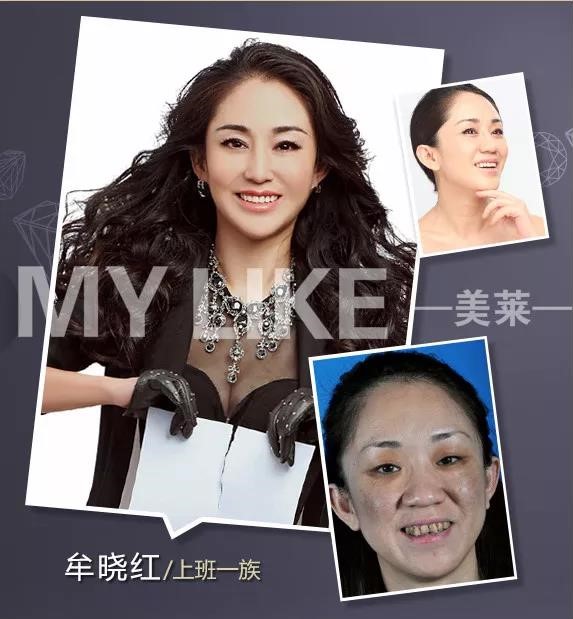 化妝品會讓黃褐斑增長嗎,預防黃褐斑有哪些方法