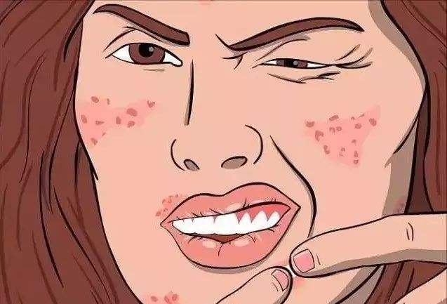 為什么額頭會長痘,怎么祛除?