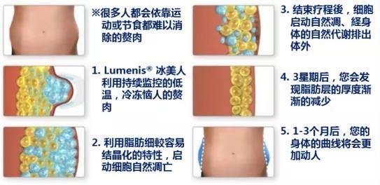 秋冬美麗不打折!讓美萊曹國靖醫(yī)師帶你一起【晶準(zhǔn)減脂 酷塑體線】