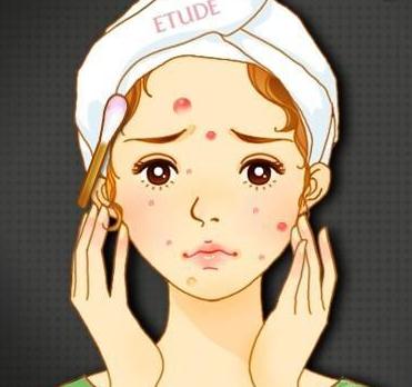 華美美萊果酸祛痘,拍照告別P圖!