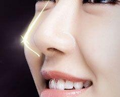 鼻子做*雕的保持時(shí)間有多長(zhǎng)