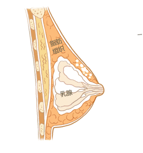 廣州美萊做自體脂肪隆胸術后會出現(xiàn)后遺癥嗎