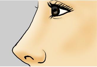 <a href='/cq/' target='_blank'><u>重慶美萊</u></a>玻尿酸隆鼻價格貴嗎？