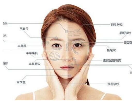 貴陽美萊做面部填充術后會出現(xiàn)副作用嗎