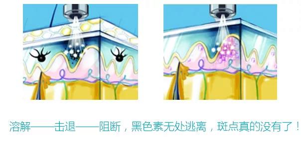 長斑和大姨媽有沒有關聯?