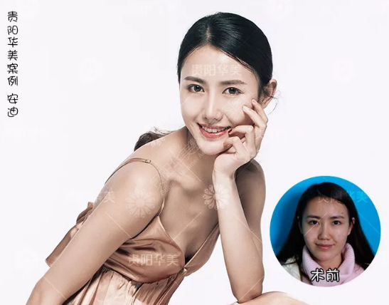 華美20周年慶,價格重回20年