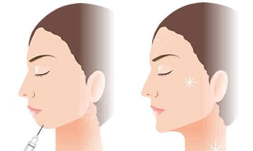 什么因素會影響假體隆下巴的效果呢?