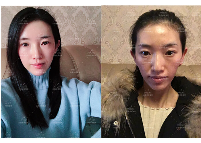 2011年環球游艇模特大賽十佳及單項獎小姐姐必做的醫美項目!!美萊雙十一get好物推薦