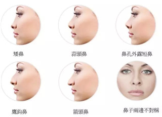 打玻尿酸鼻子會變寬，是不是真的？