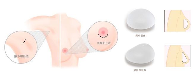 做硅膠假體隆胸會不會留下很明顯的疤痕