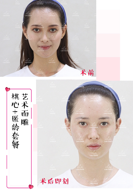 優品聚獻·超級新品周|這份爆款清單務必收下!