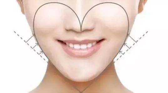 心形臉當道，艾莉薇玻尿酸可不可以打造“心形臉”