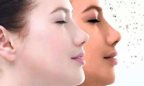 90后追捧的整容項目推薦,你喜歡什么?