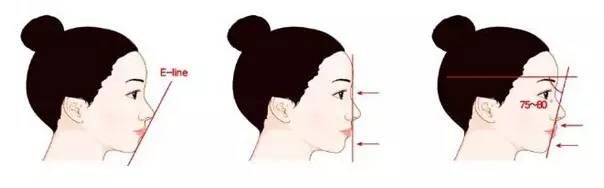 開(kāi)眼角手術(shù)