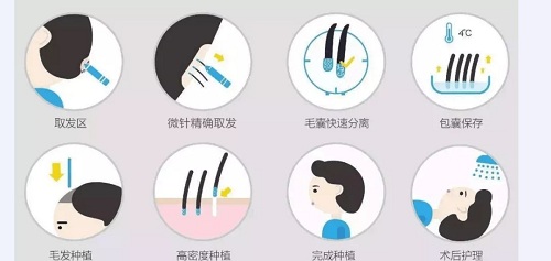 <a href='/cs/' target='_blank'><u>長沙美萊</u></a>教您怎樣拒絕禿頭——發際線拯救指南