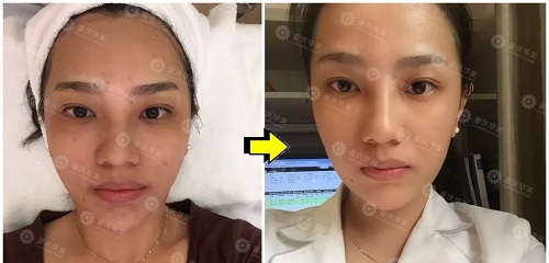 <a href='/cqhm/' target='_blank'><u>重慶華美</u></a>年終大促，直降9281