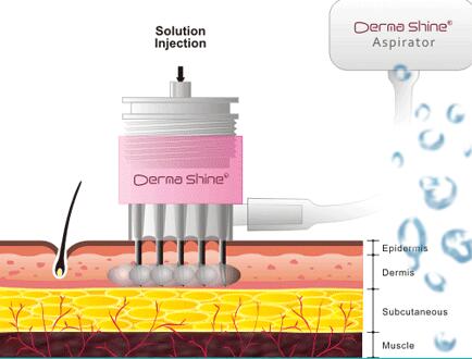 常州水光有什么優(yōu)勢(shì)嗎