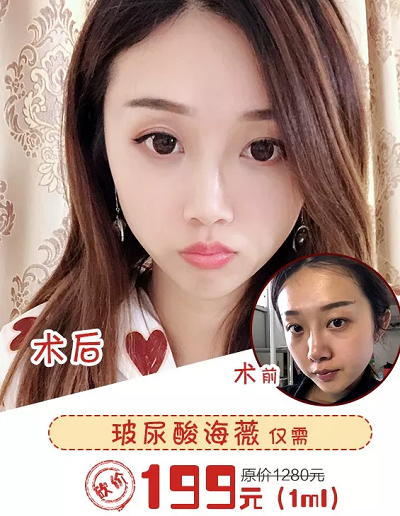 <a href='/fz/' target='_blank'><u>福州美萊</u></a>價值9.9水密碼、199玻尿酸拼團開啟!