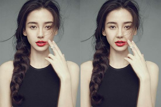 武漢如何去除法令紋?有什么好辦法?