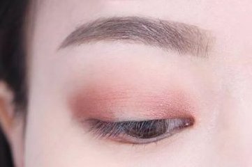 成都做全切雙眼皮適合哪些人?