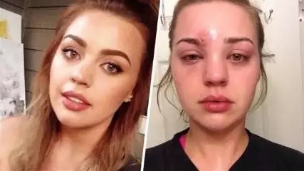 昆明祛痘哪家醫(yī)院好?