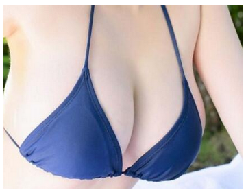 杭州做自體脂肪隆胸術(shù)創(chuàng)傷大嗎?