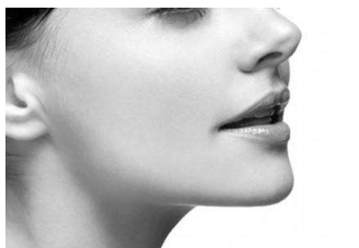 成都注射玻尿酸隆鼻術(shù)后多久定型?