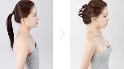 豐胸的辦法都有什么？