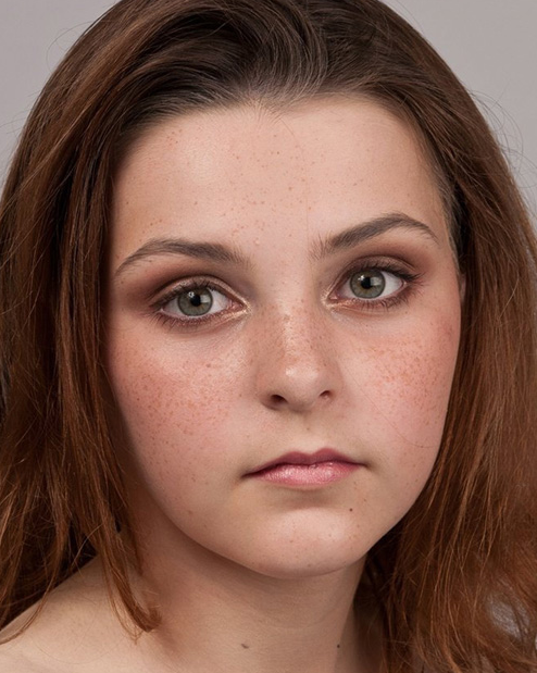 激光祛斑副作用大嗎?