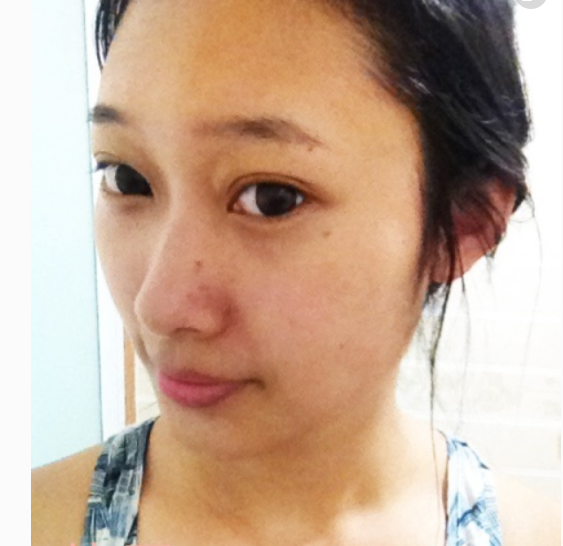 如何去臉上的斑比較有效?