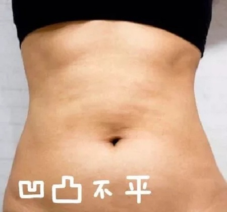 這個冬天,我“脂”在乎你,就來美萊吧