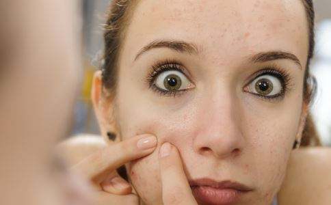 激光去痘后怎么護理?