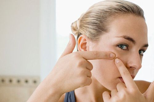 激光去痘后怎么護理?