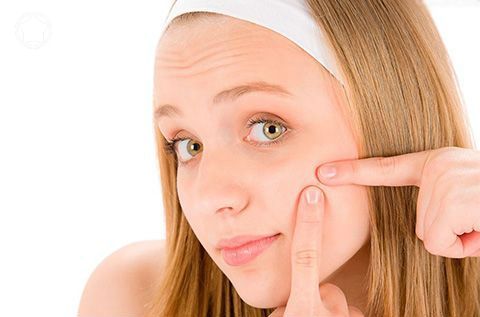 激光怎樣去痘印？有什么需要注意的？