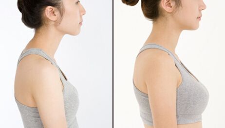 豐胸手術一般多少錢？