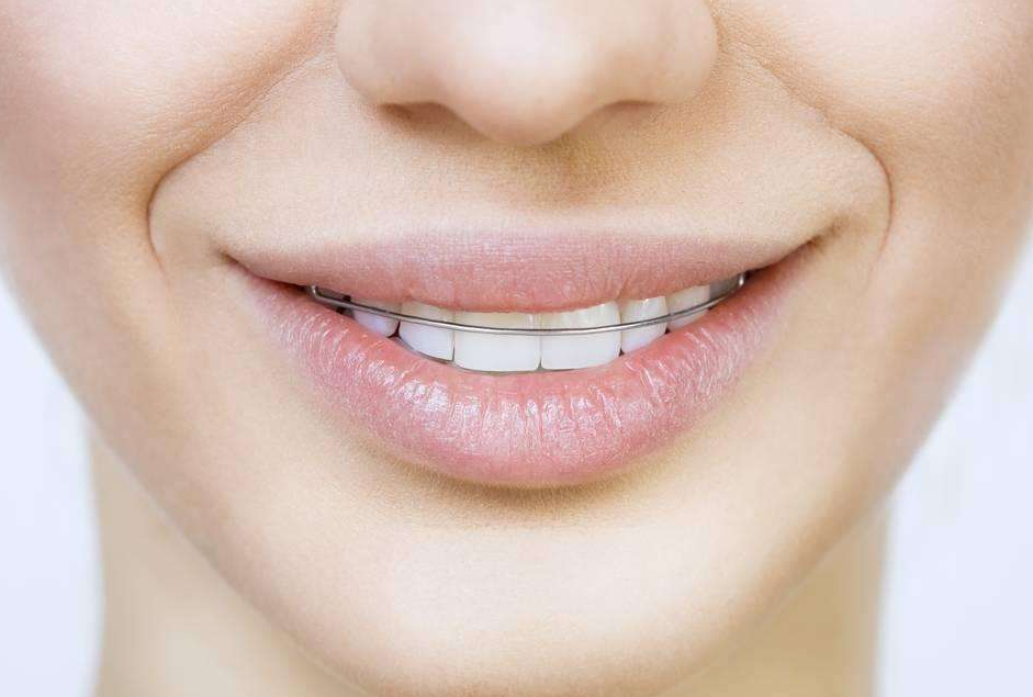 門牙矯正怎么樣?