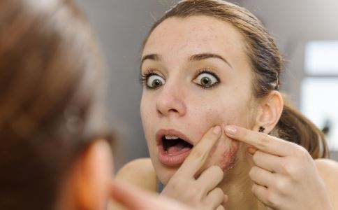 上海怎么祛痘印?