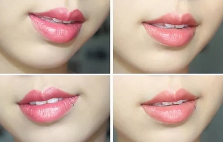 新年開運整形塑造好面相,開啟豬年鴻運之門!