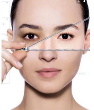 面部抽脂瘦臉效果好不好?