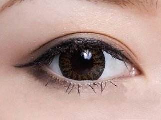 雙眼皮術后多久能恢復自然?