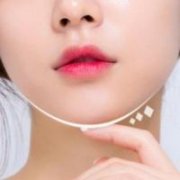 玻尿酸填充面頰效果怎么樣？