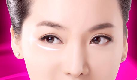 手術去眼袋要多久能恢復?