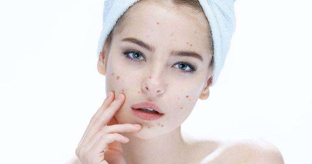 激光祛痘印真的不會損傷皮膚嗎?