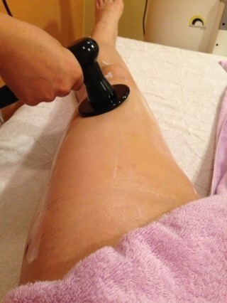 冰點激光脫毛效果好嗎?