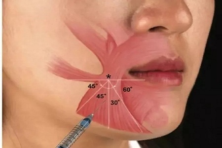 “吊命”靠口紅,沒有好看的唇形怎么行