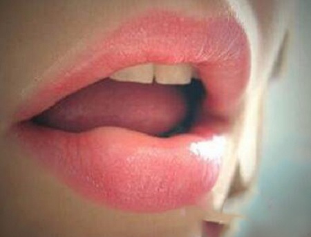 膨體墊下巴效果到底怎么樣？